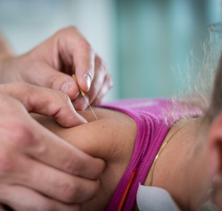 dry needling close up